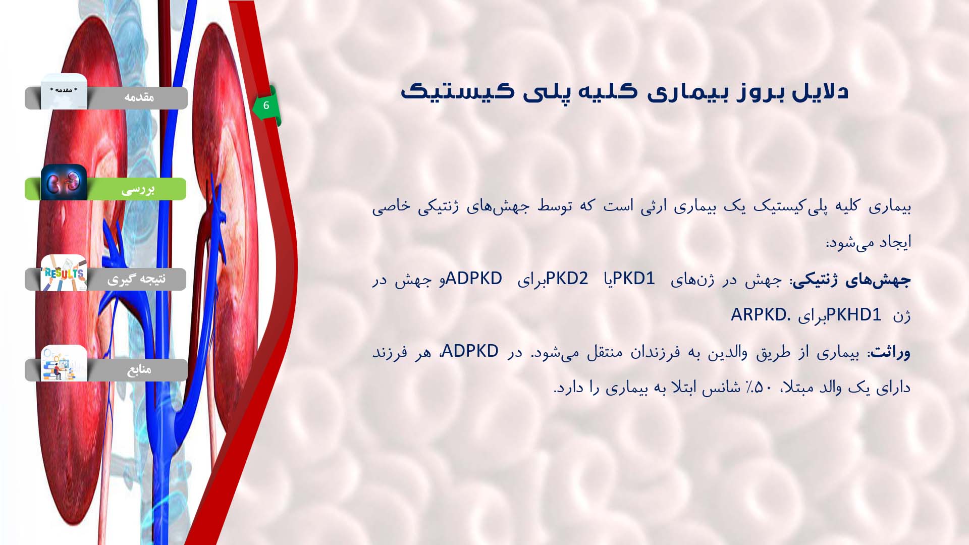 پاورپوینت در مورد بیماری کلیه پلی کیستیک (PKD)